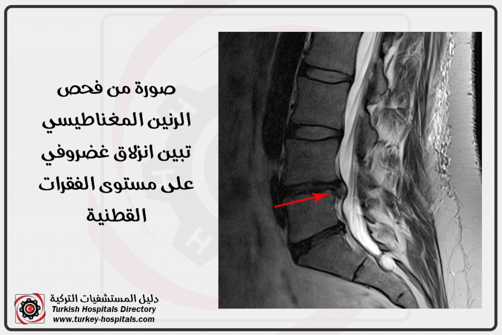 Magnetic resonance